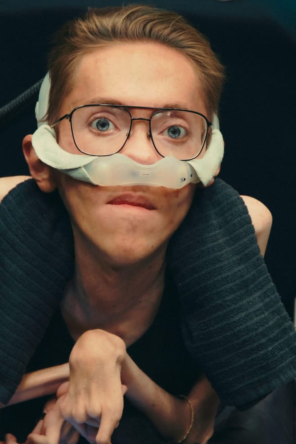 SEEN: At 25, Steve Way Learned He Had a Future. He Decided to Become an Actor.